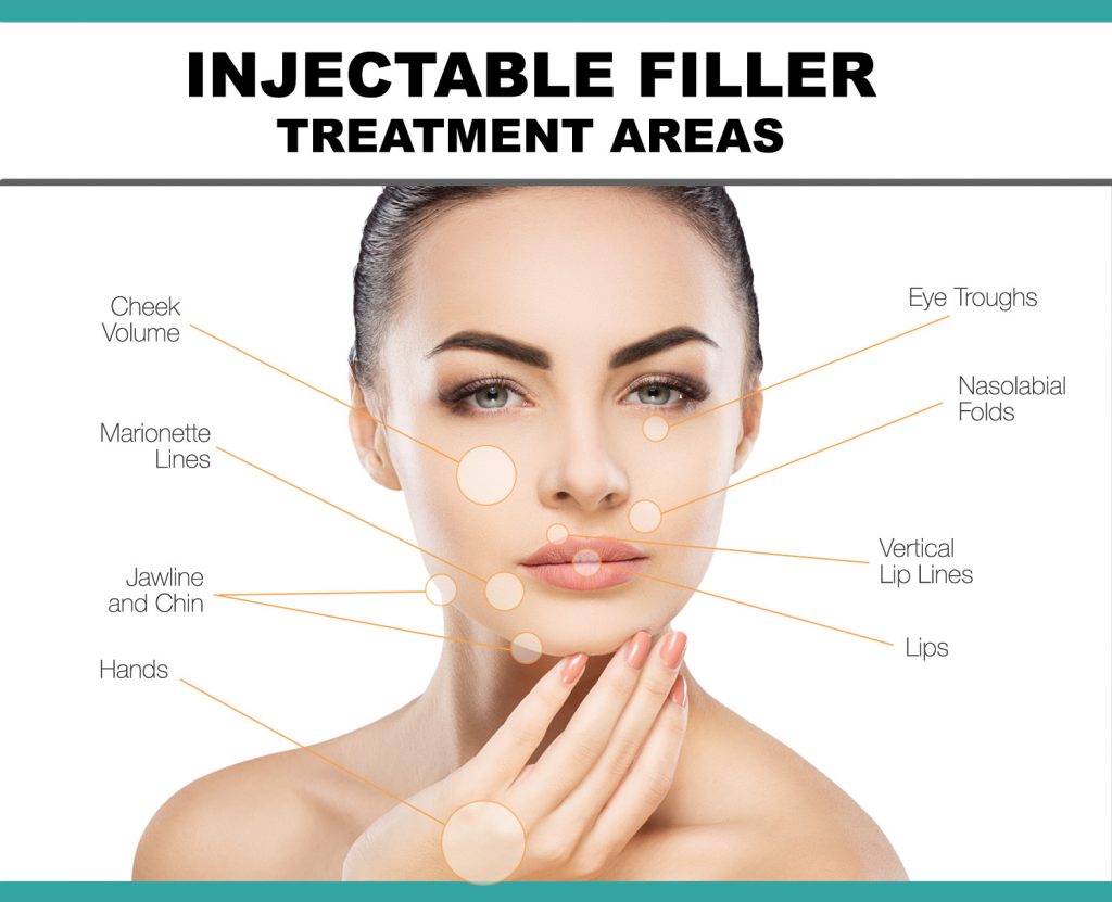 injectable-filler-treatment-areas